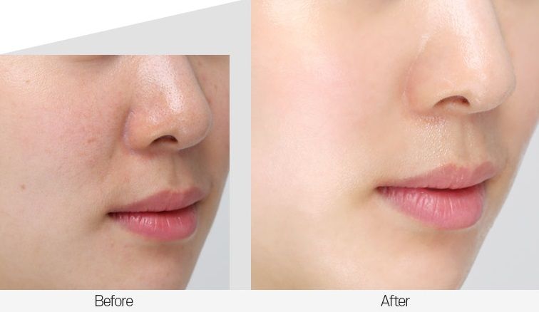 MEDI-PEEL Peptide 9 Volume Essence1_kimmi.jpg MEDI-PEEL Peptide 9 Volume Essence1_kimmi.jpg