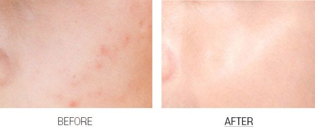 MEDI-PEEL Bamboo Cica Bomb Calming Mask_kimmi2.jpg