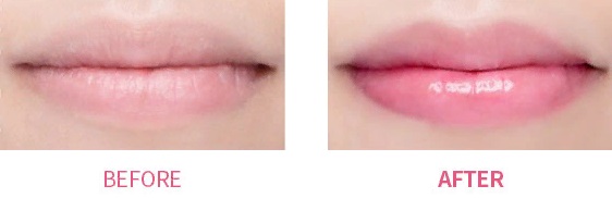YNM Lip Treatment Pack1_kimmi.jpg