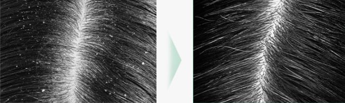 Masil 5 Probiotics Scalp Scaling Shampoo16_kimmi.jpg