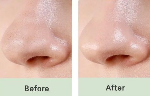 MIZON Pore Fresh Clear Nose Pack1_kimmi.jpg