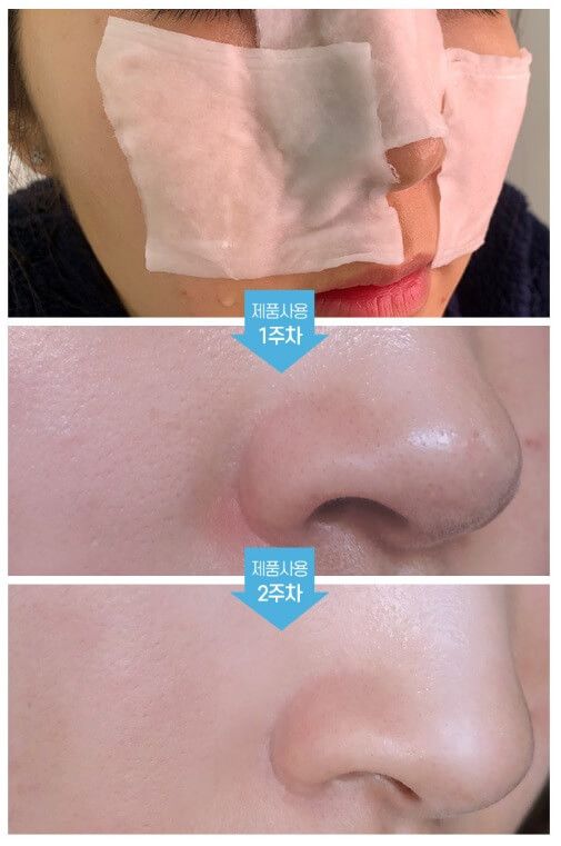 MEDI-PEEL Extra Super9 _kimmi3.jpg
