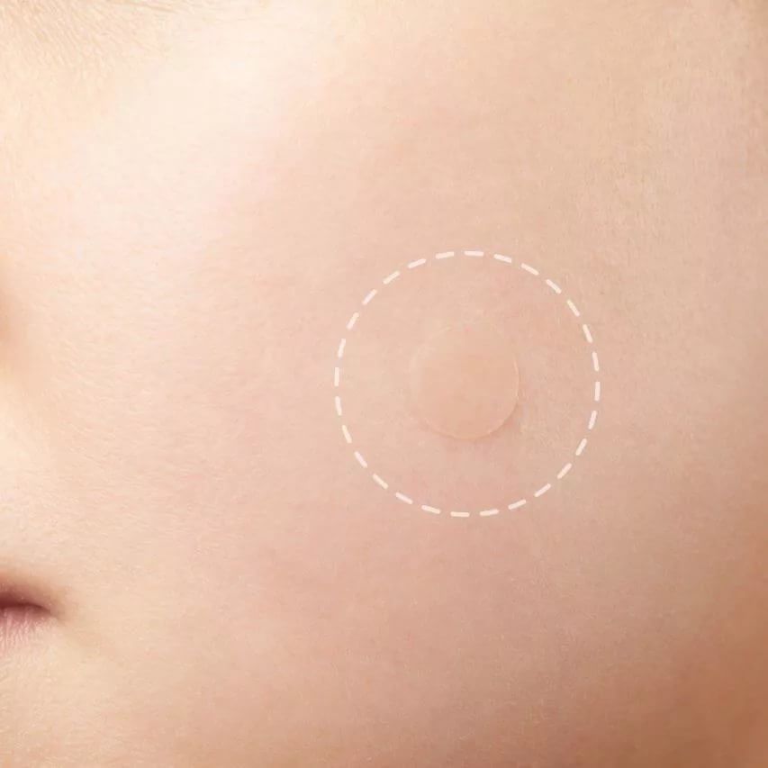 Антибактериальные наклейки против прыщей Some By Mi 30 Days Miracle Clear Spot Patch_KIMMI.jpg